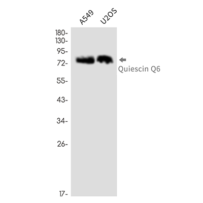 QSOX1 Rabbit Monoclonal Antibody | 兔单抗 | EnkiLife恩玑生命