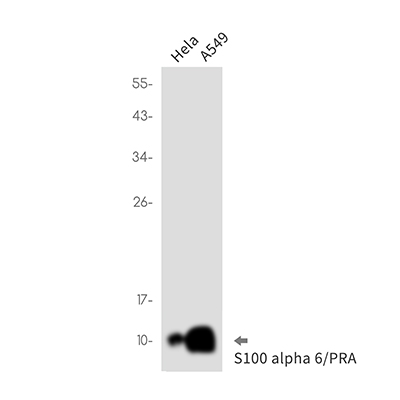 S100 alpha6 Rabbit Monoclonal Antibody | 兔单抗 | EnkiLife恩玑生命