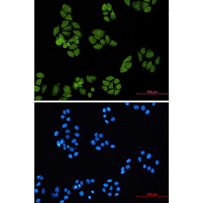 Smad4 Rabbit Monoclonal Antibody | 兔单抗 | EnkiLife恩玑生命