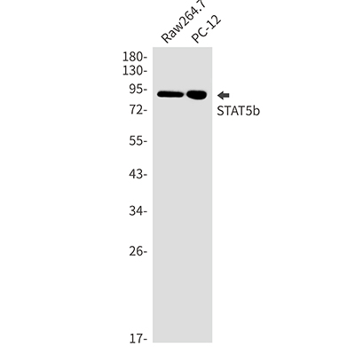 STAT5b Rabbit Monoclonal Antibody | 兔单抗 | EnkiLife恩玑生命