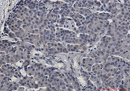 STAT5b Rabbit Monoclonal Antibody | 兔单抗 | EnkiLife恩玑生命