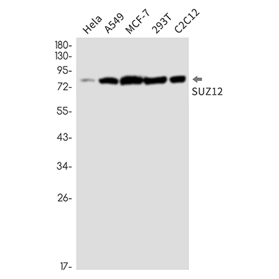 Polycomb Protein SUZ12 Rabbit Monoclonal Antibody | 兔单抗 | EnkiLife恩玑生命
