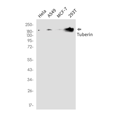Tuberin Rabbit Monoclonal Antibody | 兔单抗 | EnkiLife恩玑生命