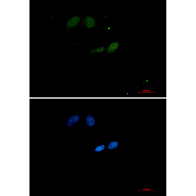 SUMO Conjugating Enzyme UBC9 Rabbit Monoclonal Antibody | 兔单抗 | EnkiLife恩玑生命