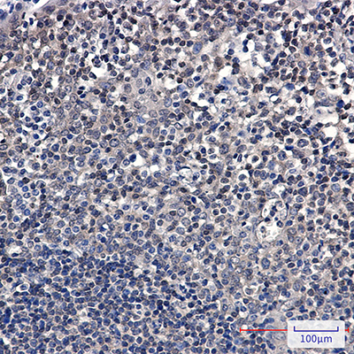 SUMO Conjugating Enzyme UBC9 Rabbit Monoclonal Antibody | 兔单抗 | EnkiLife恩玑生命