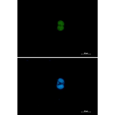 MEK3/MEK6 Rabbit Monoclonal Antibody | 兔单抗 | EnkiLife恩玑生命