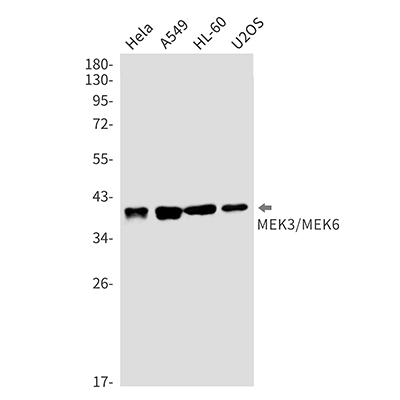MEK3/MEK6 Rabbit Monoclonal Antibody | 兔单抗 | EnkiLife恩玑生命