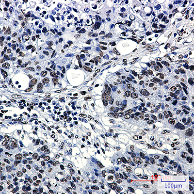Acetyl-Histone H4 (Lys5) Rabbit Monoclonal Antibody | 兔单抗 | EnkiLife恩玑生命