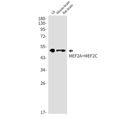 MEF2A/MEF2C Rabbit Monoclonal Antibody | 兔单抗 | EnkiLife恩玑生命