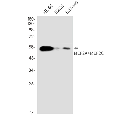 MEF2A/MEF2C Rabbit Monoclonal Antibody | 兔单抗 | EnkiLife恩玑生命