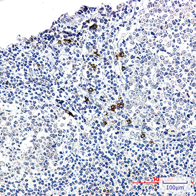 Human IgG4 Rabbit Monoclonal Antibody | 兔单抗 | EnkiLife恩玑生命