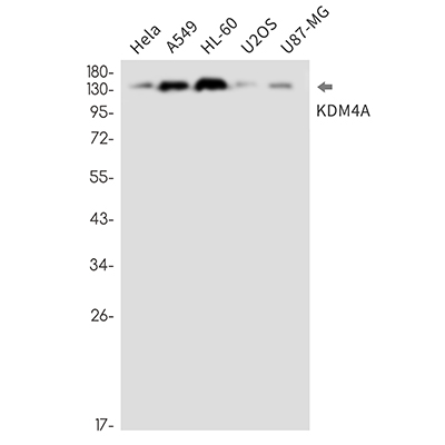 KDM4A Rabbit Monoclonal Antibody | 兔单抗 | EnkiLife恩玑生命