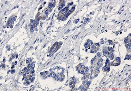 beta Catenin Rabbit Monoclonal Antibody | 兔单抗 | EnkiLife恩玑生命