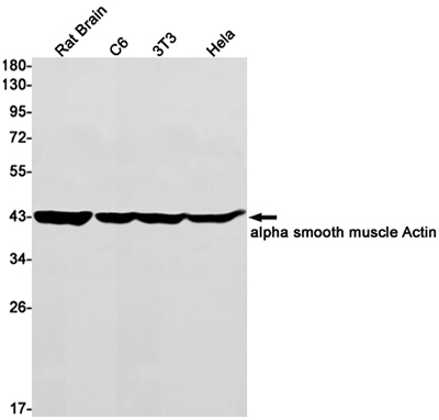 alpha Smooth Muscle Actin Rabbit Monoclonal Antibody | 兔单抗 | EnkiLife恩玑生命