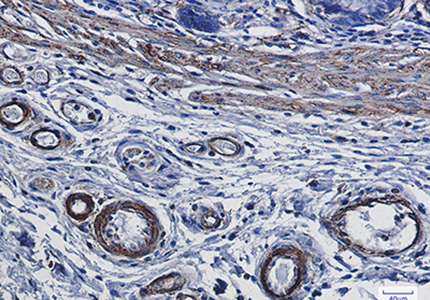 alpha Smooth Muscle Actin Rabbit Monoclonal Antibody | 兔单抗 | EnkiLife恩玑生命