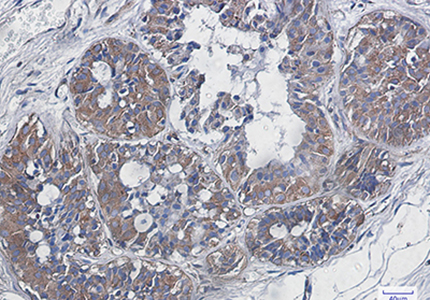 NF-KB p65 Rabbit Monoclonal Antibody | 兔单抗 | EnkiLife恩玑生命
