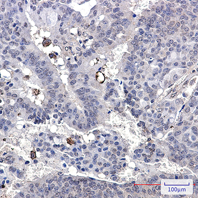 Paxillin Rabbit Monoclonal Antibody | 兔单抗 | EnkiLife恩玑生命