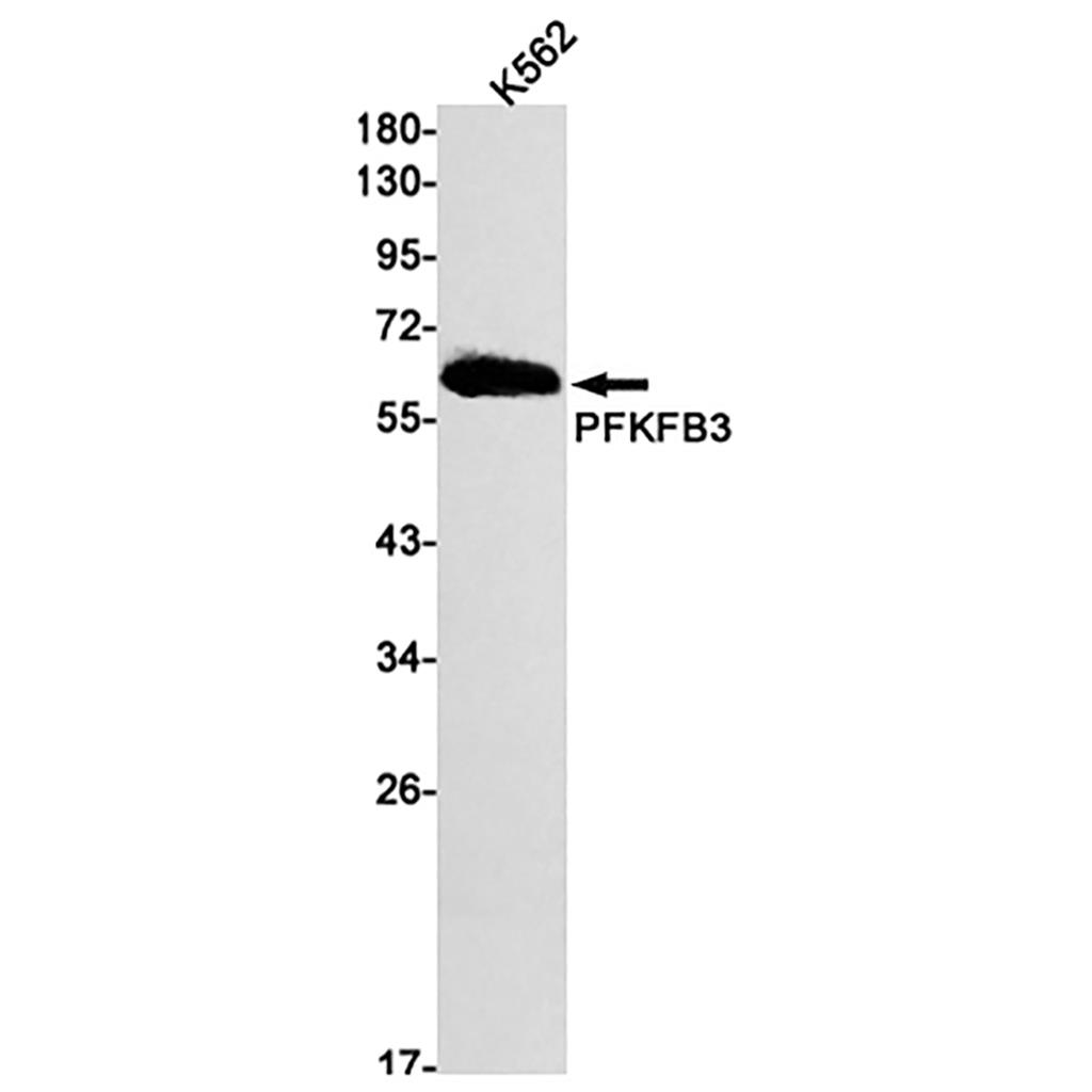 PFKFB3 Rabbit Monoclonal Antibody | 兔单抗 | EnkiLife恩玑生命
