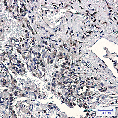 Nampt Rabbit Monoclonal Antibody | 兔单抗 | EnkiLife恩玑生命