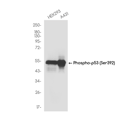 Phospho-p53 (Ser392) Rabbit Monoclonal Antibody | 兔单抗 | EnkiLife恩玑生命