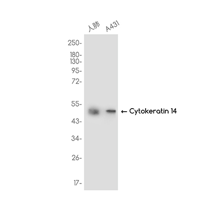Cytokeratin 14 Rabbit Monoclonal Antibody | 兔单抗 | EnkiLife恩玑生命