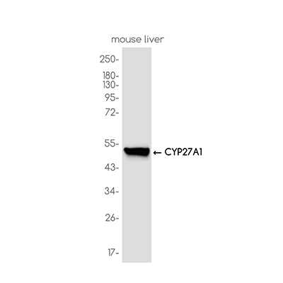 CYP27A1 Rabbit Monoclonal Antibody | 兔单抗 | EnkiLife恩玑生命