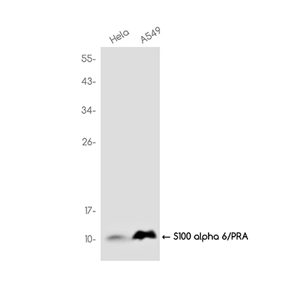 S100 alpha 6/PRA Rabbit Monoclonal Antibody | 兔单抗 | EnkiLife恩玑生命