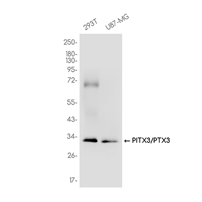 PITX3/PTX3 Rabbit Monoclonal Antibody | 兔单抗 | EnkiLife恩玑生命