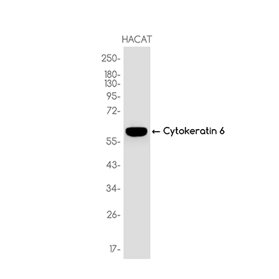 Cytokeratin 6 Rabbit Monoclonal Antibody | 兔单抗 | EnkiLife恩玑生命
