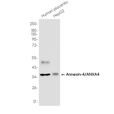 Annexin 4/ANXA4 Rabbit Monoclonal Antibody | 兔单抗 | EnkiLife恩玑生命