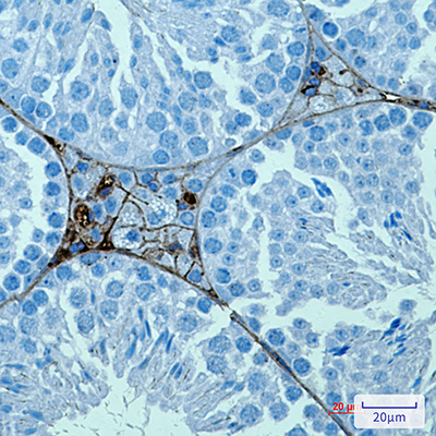 PRAME Rabbit Monoclonal Antibody | 兔单抗 | EnkiLife恩玑生命