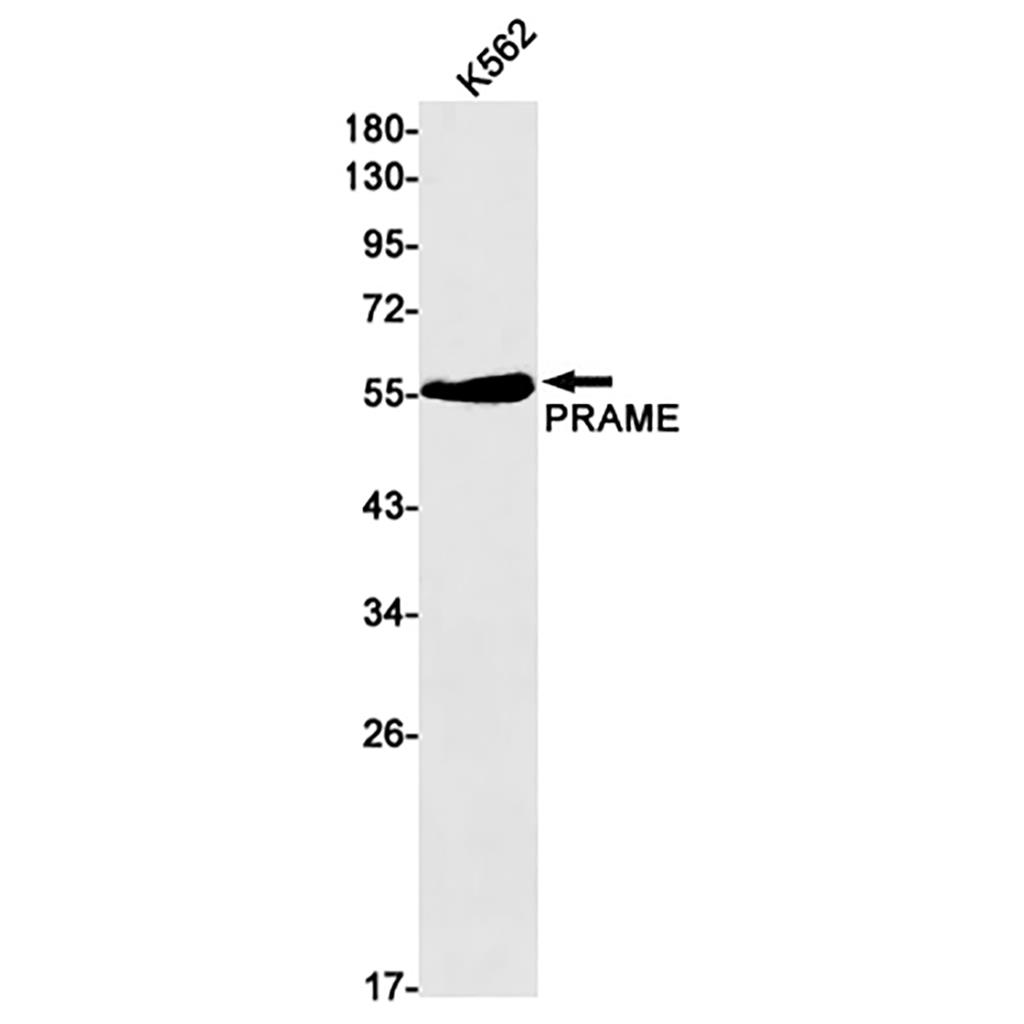 PRAME Rabbit Monoclonal Antibody | 兔单抗 | EnkiLife恩玑生命