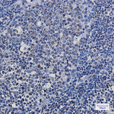 TAF15 Rabbit Monoclonal Antibody | 兔单抗 | EnkiLife恩玑生命
