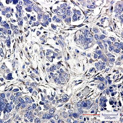 LRP1 Rabbit Monoclonal Antibody | 兔单抗 | EnkiLife恩玑生命