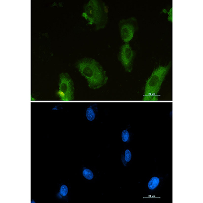 ALDOA Rabbit Monoclonal Antibody | 兔单抗 | EnkiLife恩玑生命