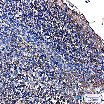 ALDOA Rabbit Monoclonal Antibody | 兔单抗 | EnkiLife恩玑生命