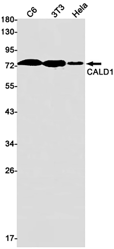 Caldesmon Rabbit Monoclonal Antibody | 兔单抗 | EnkiLife恩玑生命