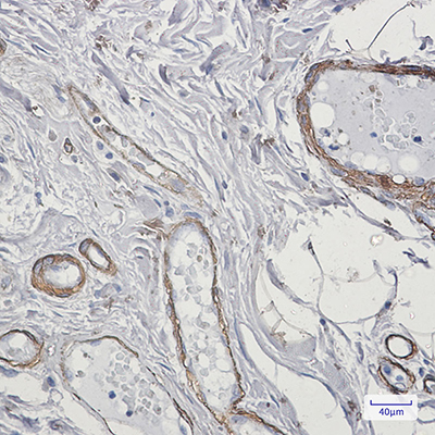 Caldesmon Rabbit Monoclonal Antibody | 兔单抗 | EnkiLife恩玑生命