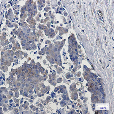 EGFR Rabbit Monoclonal Antibody | 兔单抗 | EnkiLife恩玑生命