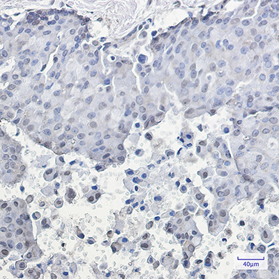 Phospho-HSF1 (Ser326) Rabbit Monoclonal Antibody | 兔单抗 | EnkiLife恩玑生命