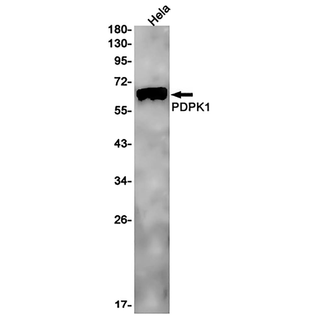PDPK1 Rabbit Monoclonal Antibody | 兔单抗 | EnkiLife恩玑生命