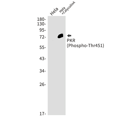 Phospho-PKR (Thr451) Rabbit Monoclonal Antibody | 兔单抗 | EnkiLife恩玑生命