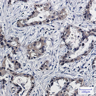 PSMB10 Rabbit Monoclonal Antibody | 兔单抗 | EnkiLife恩玑生命