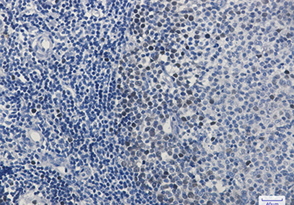 CDK2 Rabbit Monoclonal Antibody | 兔单抗 | EnkiLife恩玑生命