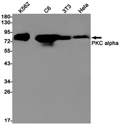 PKC alpha Rabbit Monoclonal Antibody | 兔单抗 | EnkiLife恩玑生命