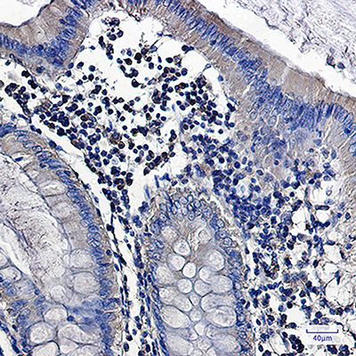 PKC alpha Rabbit Monoclonal Antibody | 兔单抗 | EnkiLife恩玑生命