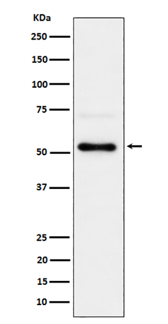 Phospho-Chk1 (S280) (9M10) Rabbit Monoclonal Antibody | 兔单抗 | EnkiLife恩玑生命