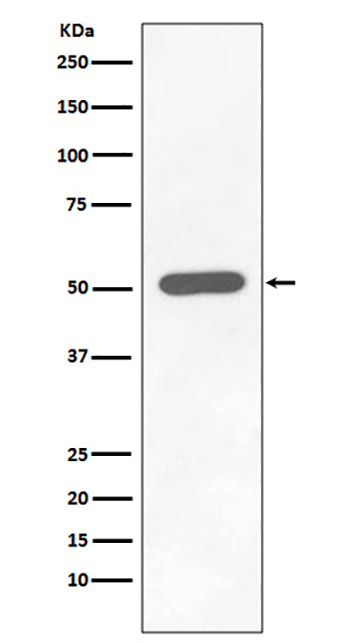 Phospho-Chk1 (S296) (14A3) Rabbit Monoclonal Antibody | 兔单抗 | EnkiLife恩玑生命