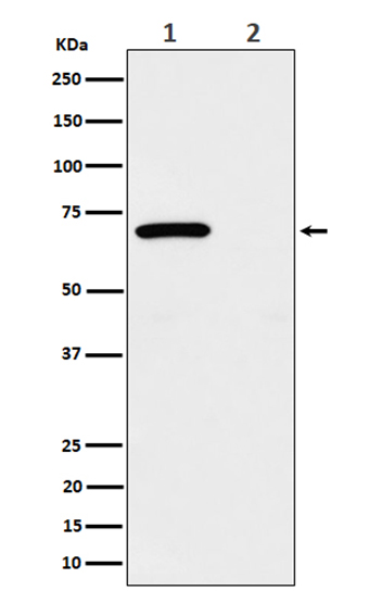Phospho-Chk2 (T68) (17G19) Rabbit Monoclonal Antibody | 兔单抗 | EnkiLife恩玑生命