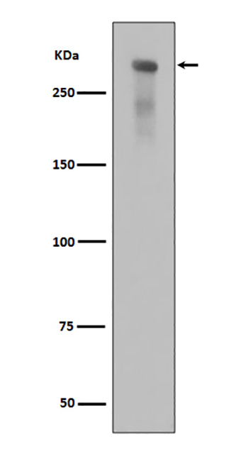 Phospho-DNA PKcs (S2056) (5N13) Rabbit Monoclonal Antibody | 兔单抗 | EnkiLife恩玑生命
